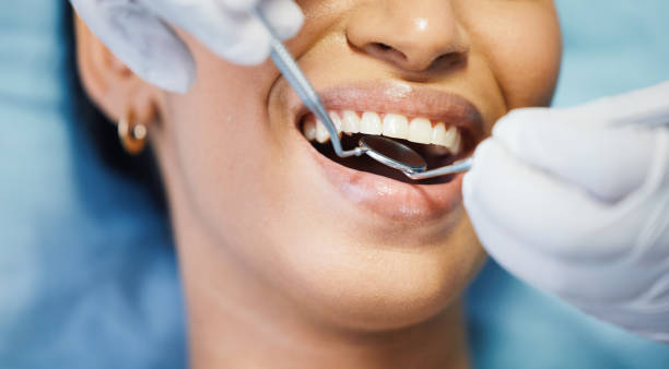 Best Emergency Treatment for Oral Infections in Lido Beach, NY